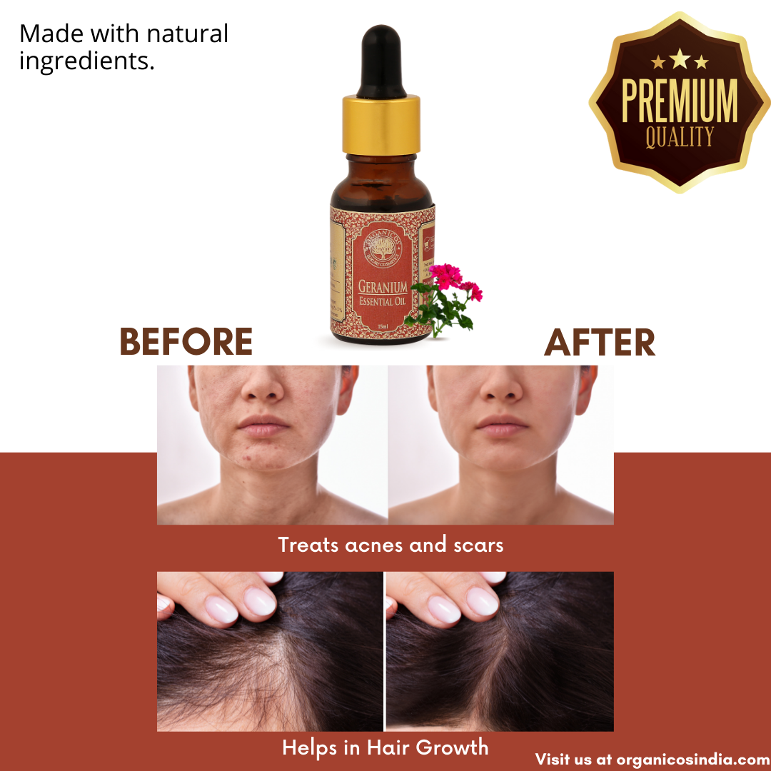 Geranium Essential Oil 15 ml