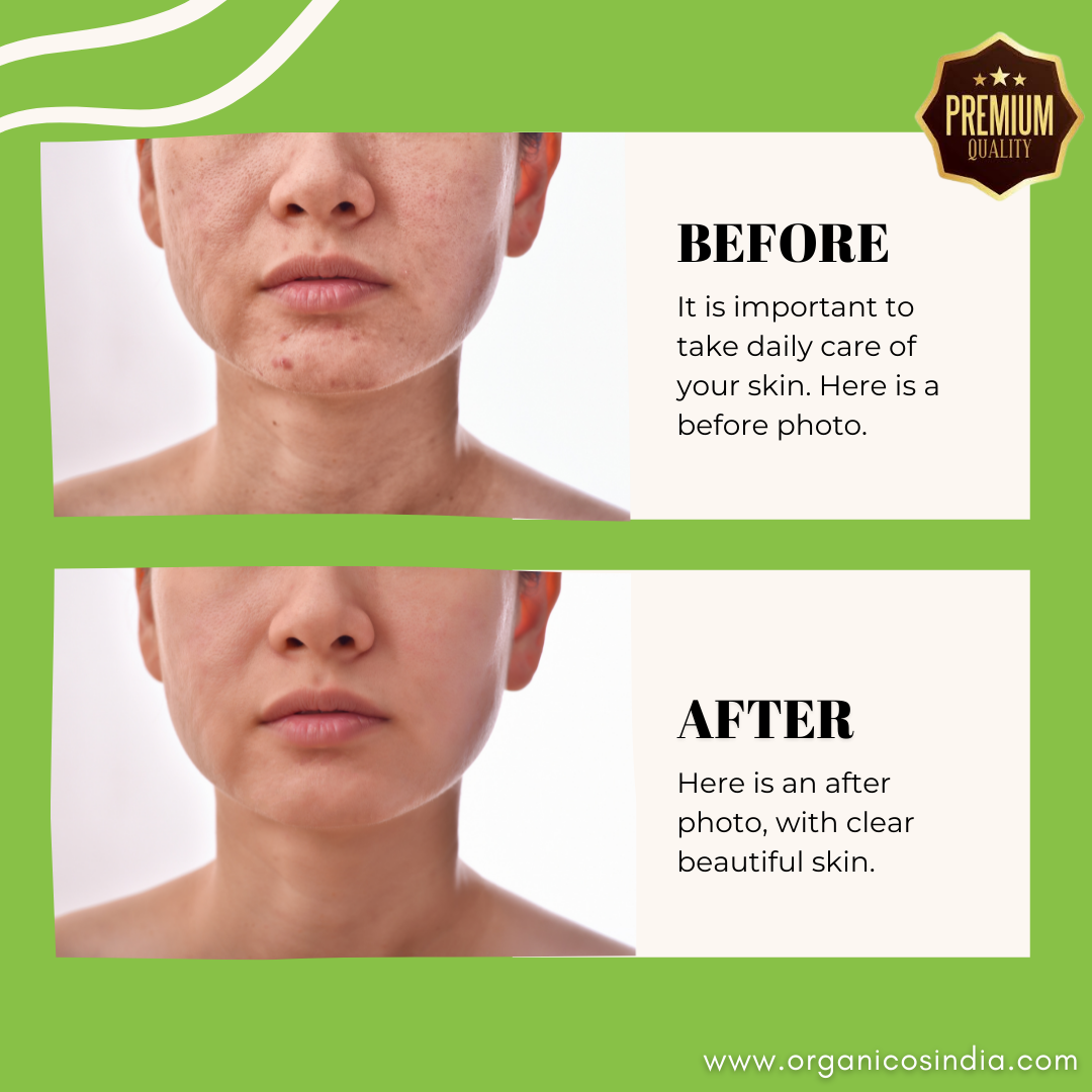Neem & Tea Tree Face Cleanser 50 ML