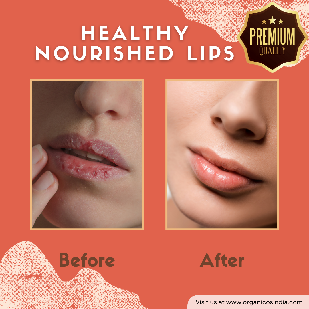 Rose Lip Balm