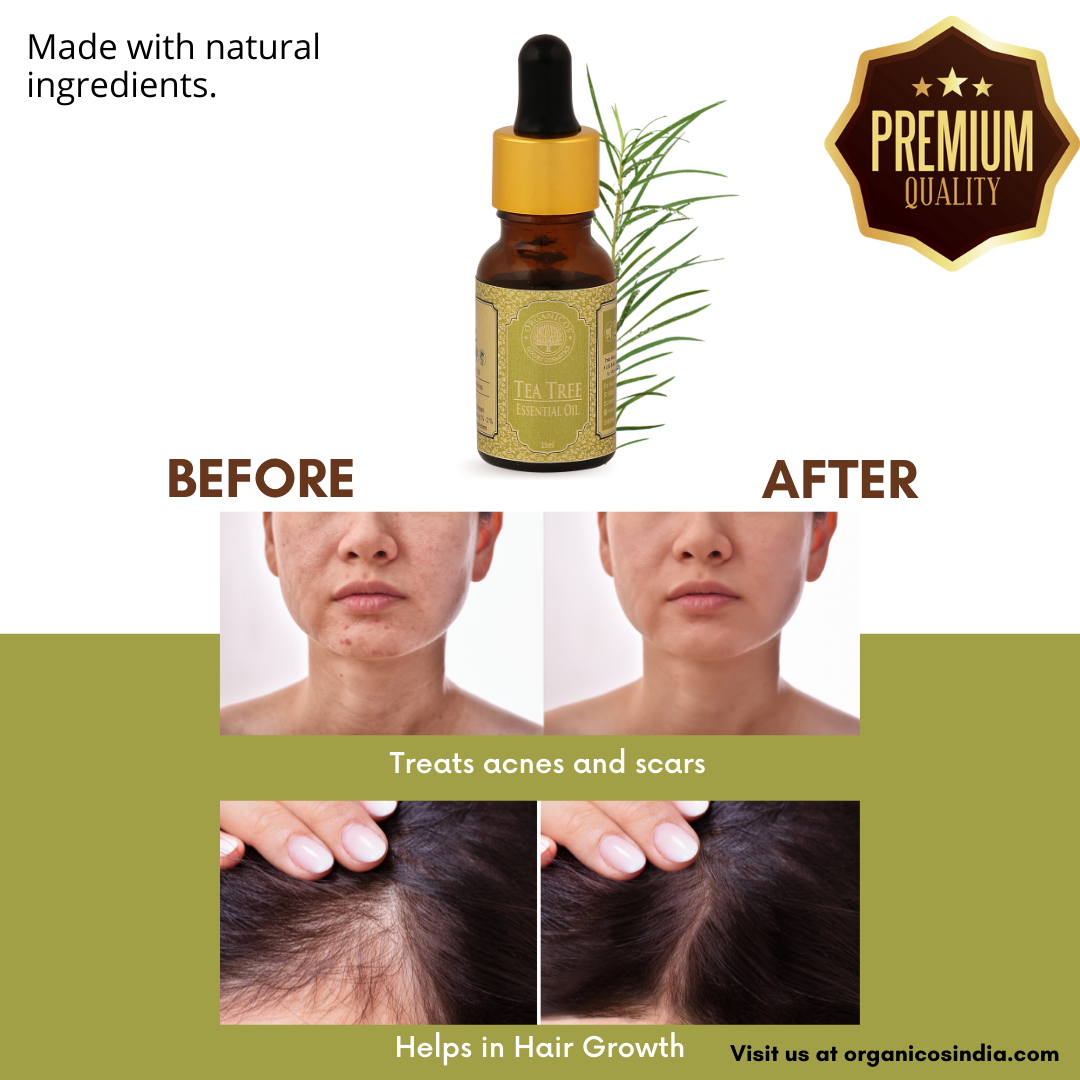 Tea Tree Essential Oil 15 ml