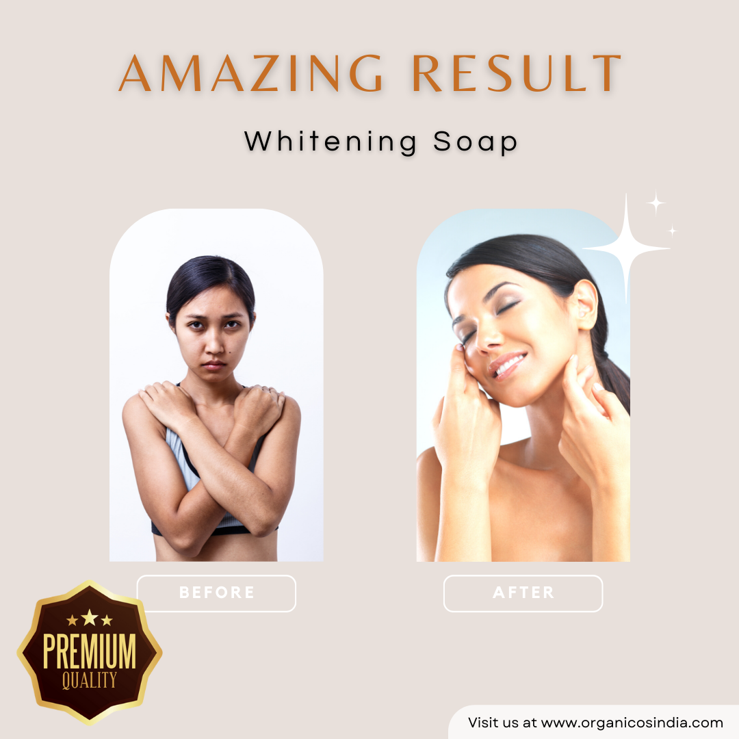 Skin Whitening Soap 100 g