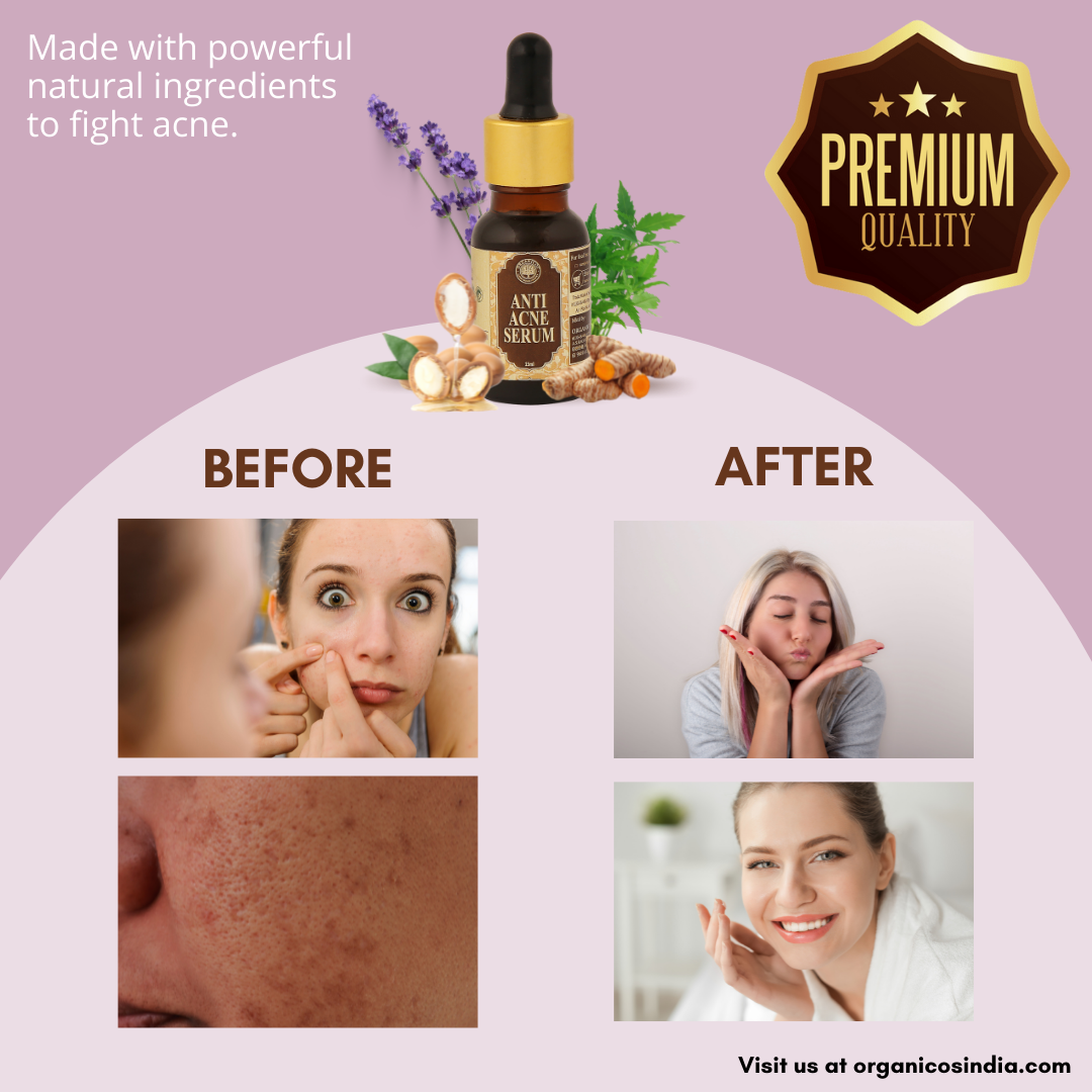 Anti Acne Serum 15 ml