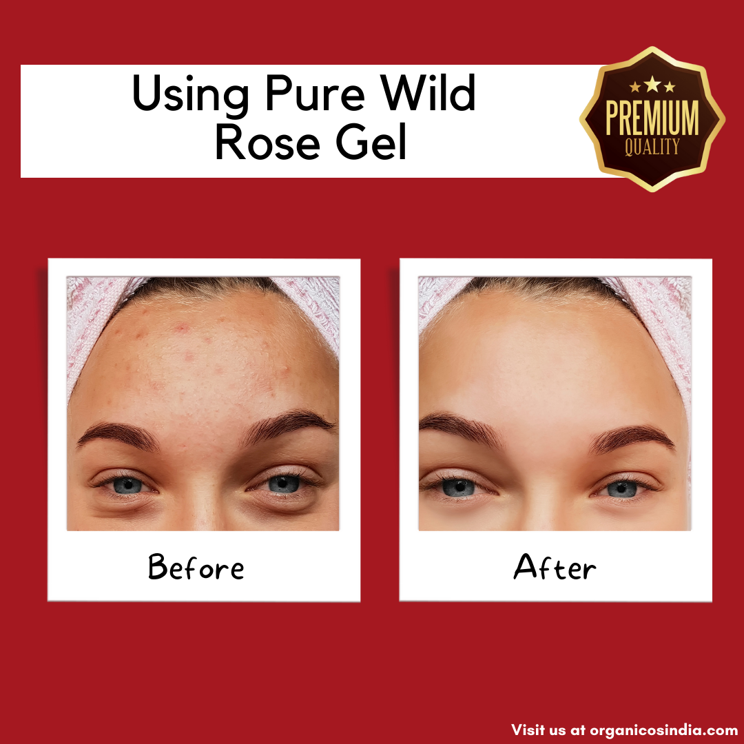 PURE WILD ROSE GEL 150 G