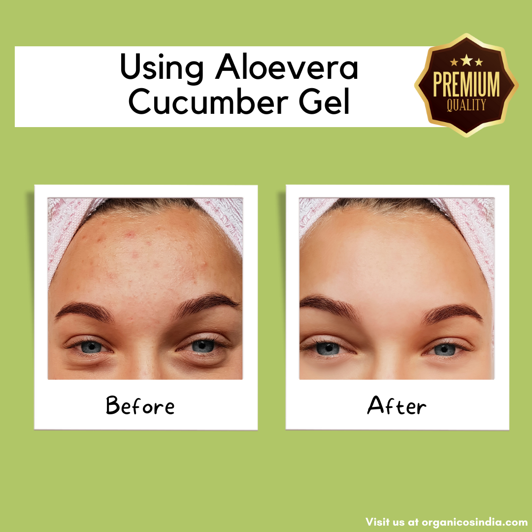 ALOEVERA CUCUMBER GEL 150 G