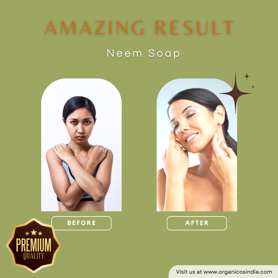 NEEM SOAP 100 G