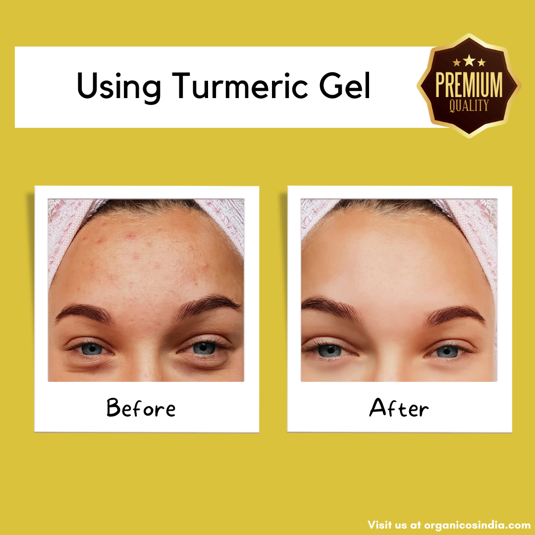PURE TURMERIC GEL 150 G