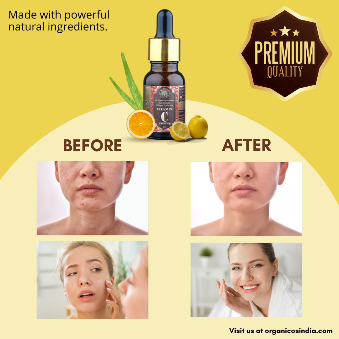 Vitamin -C Serum 15 ml