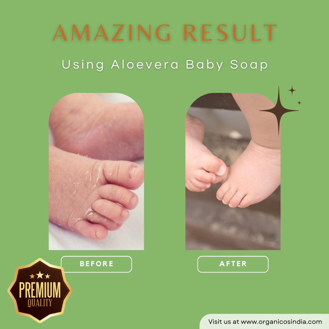 Aloevera Baby Soap 100g