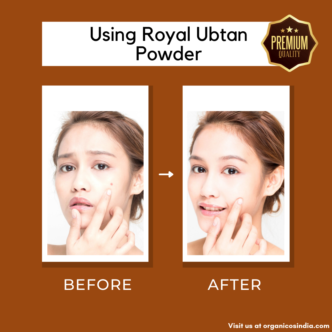 Royal Ubtan 250 gms