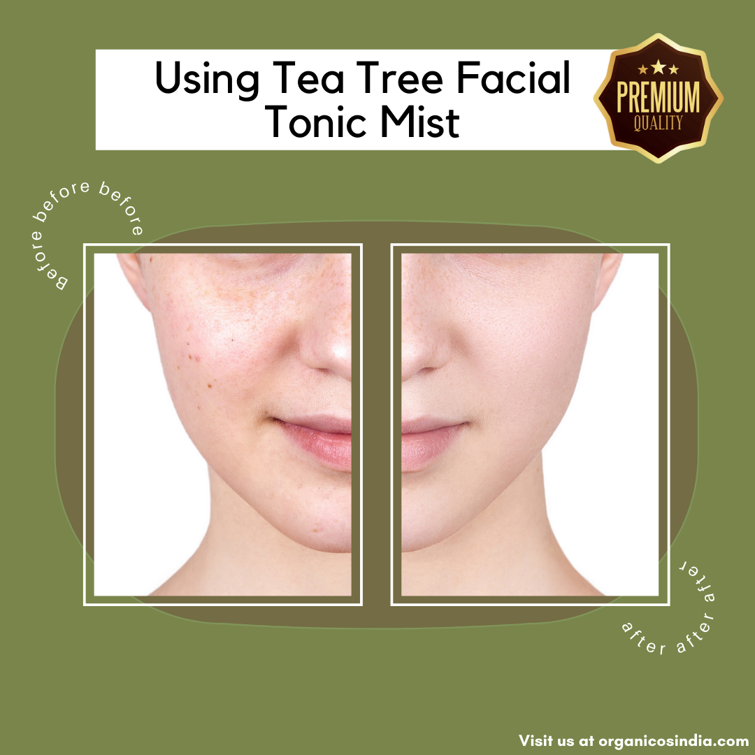 Tea Tree Facial Tonic Mist 100 ml