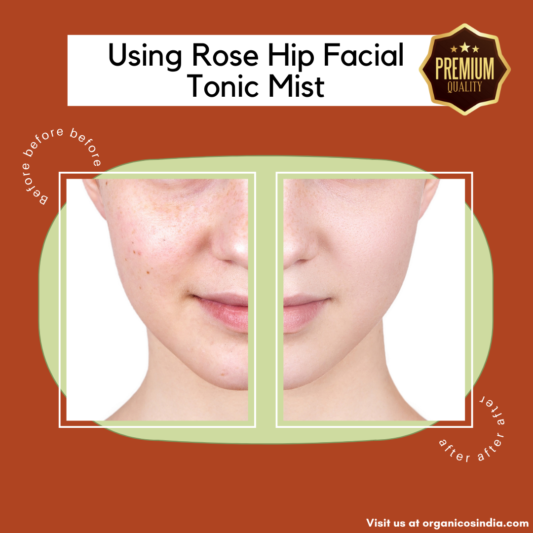 Rose Hip Facial Tonic Mist