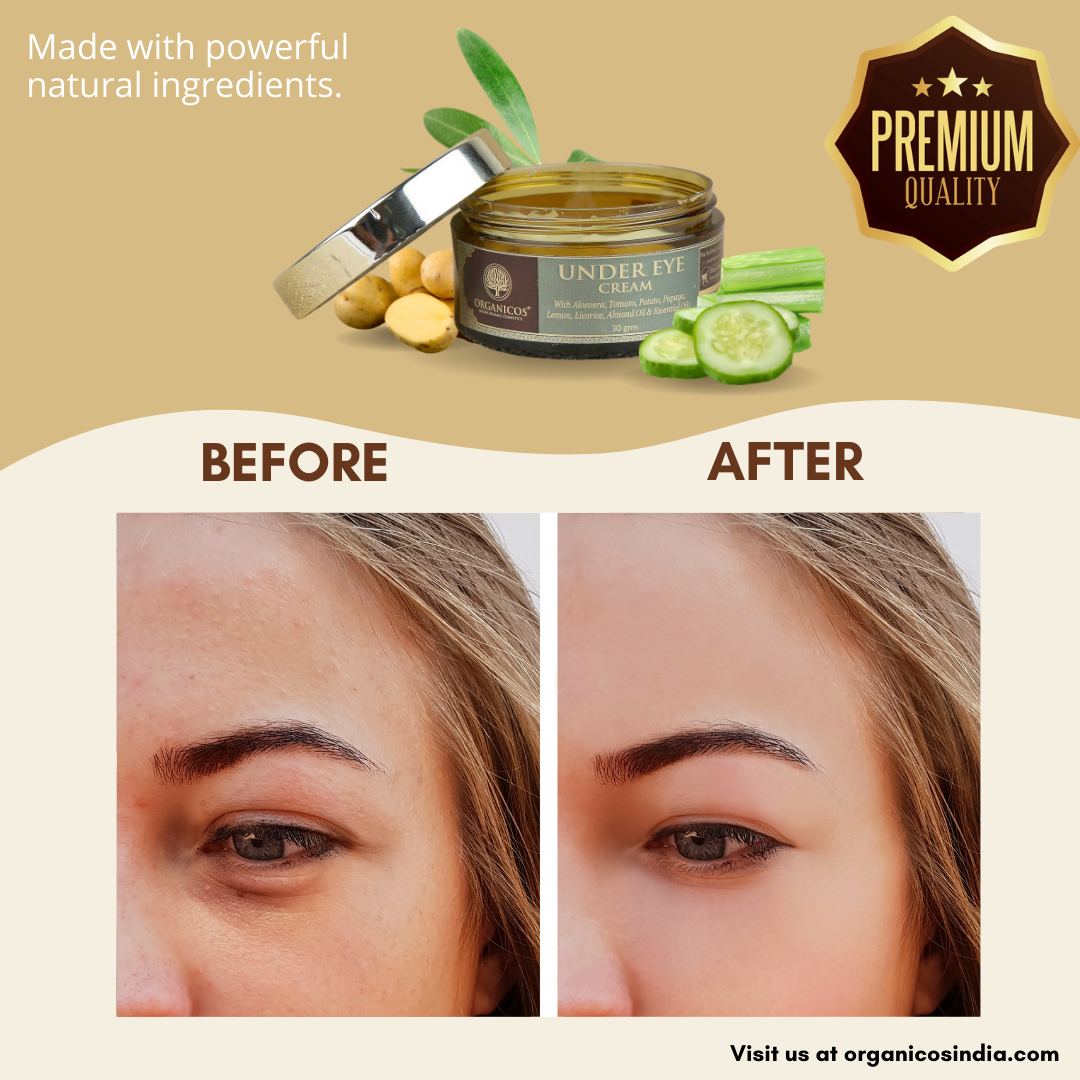 UNDER EYE CREAM 30 G